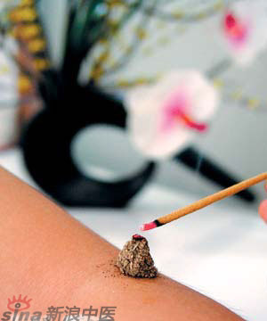 節(jié)氣灸” 冬至，你灸了嗎？