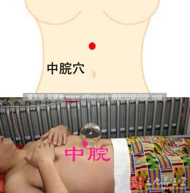 中脘穴位于腹部正中線，臍上4寸的位置上。每天艾灸10-15分鐘，能有效緩解胃部不適的癥狀，同時(shí)有助于祛濕。